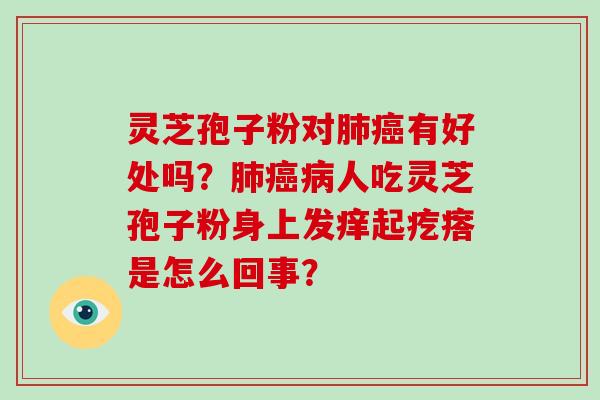 灵芝孢子粉对有好处吗？人吃灵芝孢子粉身上发痒起疙瘩是怎么回事？
