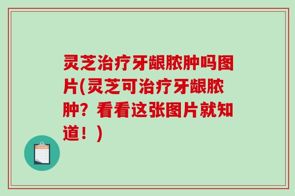 灵芝治疗牙龈脓肿吗图片(灵芝可治疗牙龈脓肿？看看这张图片就知道！)